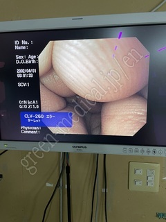 OLYMPUS Processor & Light Source