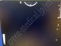 GE Healthcare Ultrasound Color Doppler