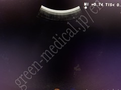 Hitachi Ultrasound Color Doppler