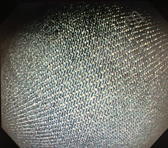 OLYMPUS Video Gastroscope