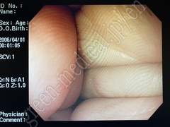 OLYMPUS Gastrointestinal Videoscope