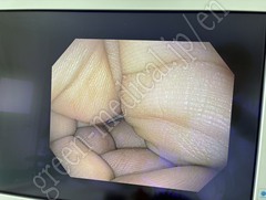 OLYMPUS Video Gastroscope