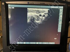 SonoSite Ultrasound Color Doppler