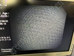 OLYMPUS Video Gastroscope