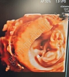 Hitachi Diagnostic Ultrasound Scanner