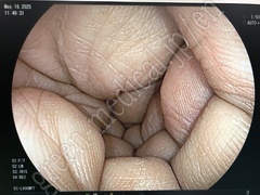 FUJIFILM Video Colonoscope