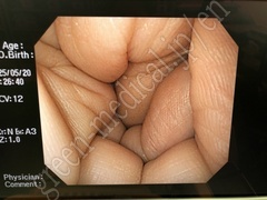 OLYMPUS Video Gastroscope