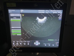 GE Healthcare Ultrasound Color Doppler