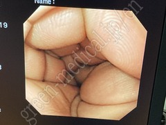 OLYMPUS Video Gastroscope