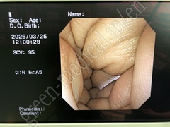 OLYMPUS Video Transnasal Gastroscope