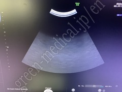 GE Healthcare Diagnostic Ultrasound System