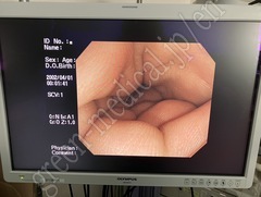 OLYMPUS Video Colonoscope