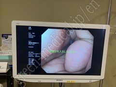 OLYMPUS Video Transnasal Gastroscope