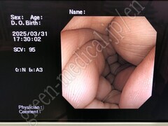 OLYMPUS Video Colonoscope