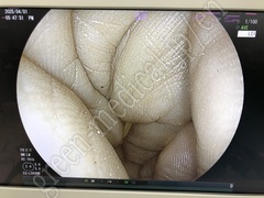 FUJIFILM Video Transnasal Gastroscope