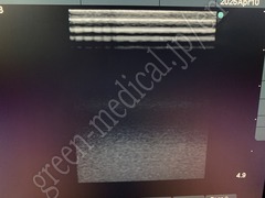 SonoSite Ultrasound Color Doppler