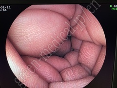 FUJIFILM Video Colonoscope