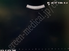 Hitachi Color Doppler Ultrasound System