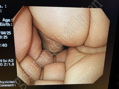 OLYMPUS Video Gastroscope