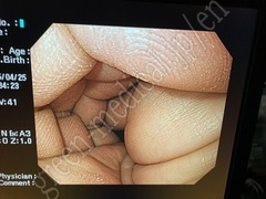OLYMPUS Video Gastroscope