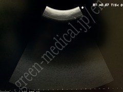 Hitachi Color Doppler Ultrasound System