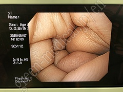 OLYMPUS Video Gastroscope