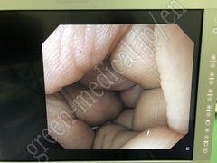 OLYMPUS Video Gastroscope