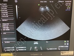 GE Healthcare Portable Ultrasound