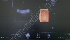 GE Healthcare 