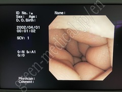 OLYMPUS Video Transnasal Gastroscope