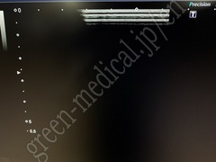 TOSHIBA Ultrasound Color Doppler