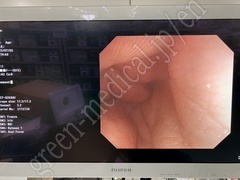 OLYMPUS Video Colonoscope