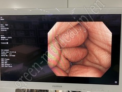 OLYMPUS Video Colonoscope