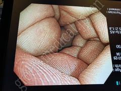 OLYMPUS Video Gastroscope