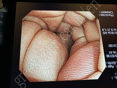 OLYMPUS Video Gastroscope