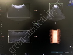 GE Healthcare Diagnostic Ultrasound System