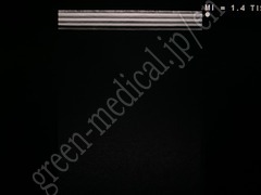 Hitachi Color Doppler Ultrasound System