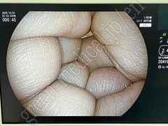 FUJIFILM Processor & Laser Lightsource