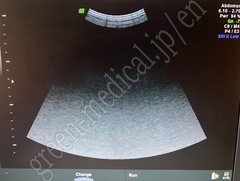GE Healthcare Portable Ultrasound