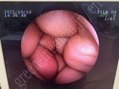 FUJIFILM Video Gastroscope