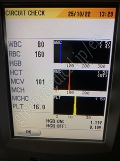 NIHON KOHDEN Hematology Analyzer