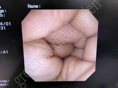 OLYMPUS Video Colonoscope