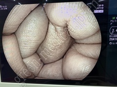 FUJIFILM Processor & Laser Lightsource