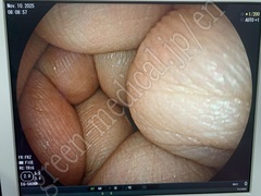 FUJIFILM Video Transnasal Gastroscope