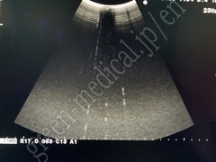 Hitachi Ultrasound Color Doppler