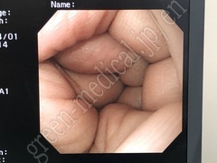 OLYMPUS Video Gastroscope