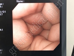 OLYMPUS Video Gastroscope