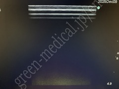 SonoSite Ultrasound Color Doppler