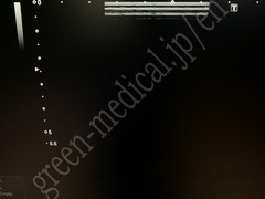 TOSHIBA Ultrasound Color Doppler