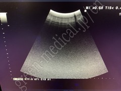 Hitachi Ultrasound Color Doppler